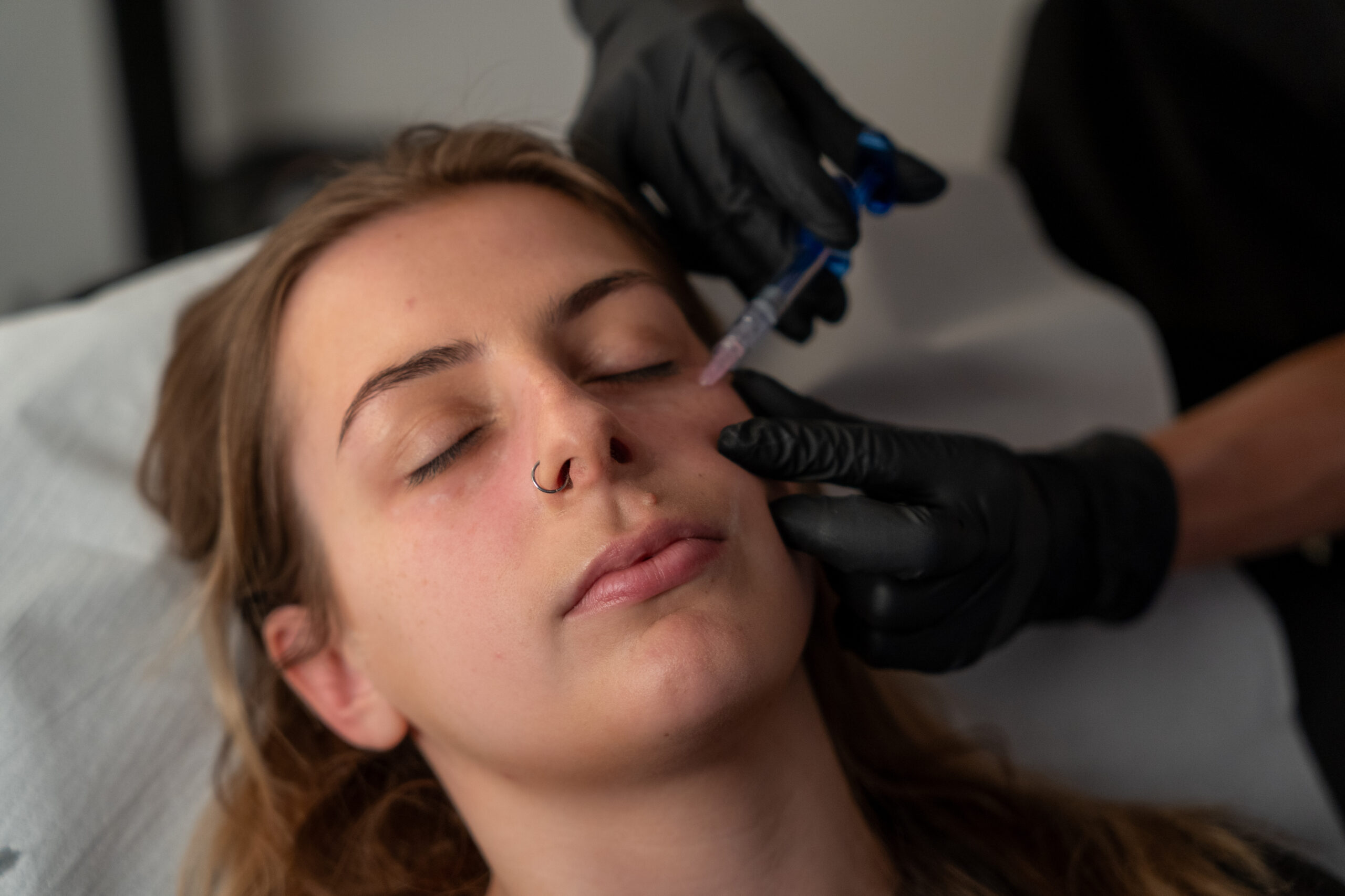 skin treatments bristol