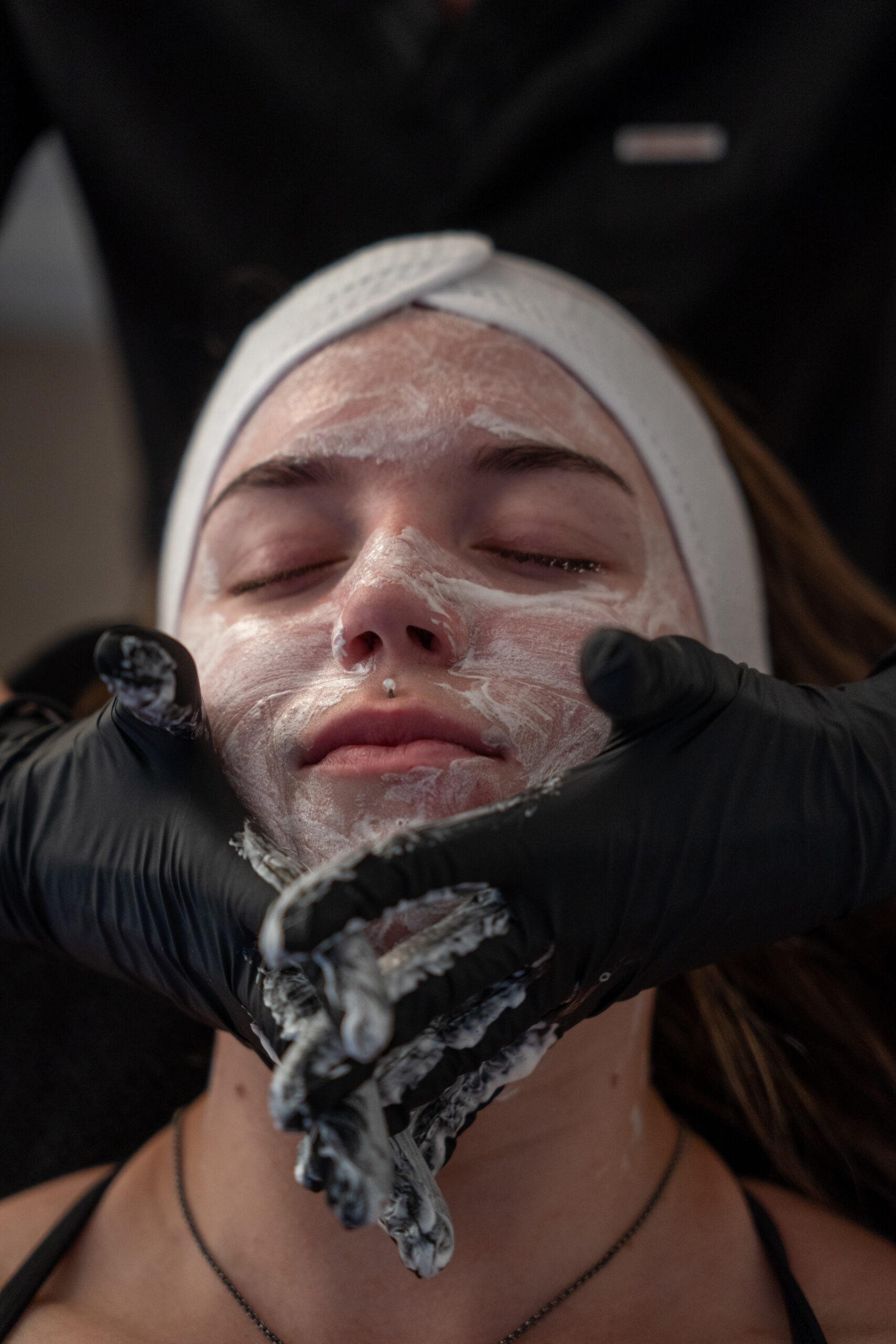 Skin tightening treatment at SculptSkin