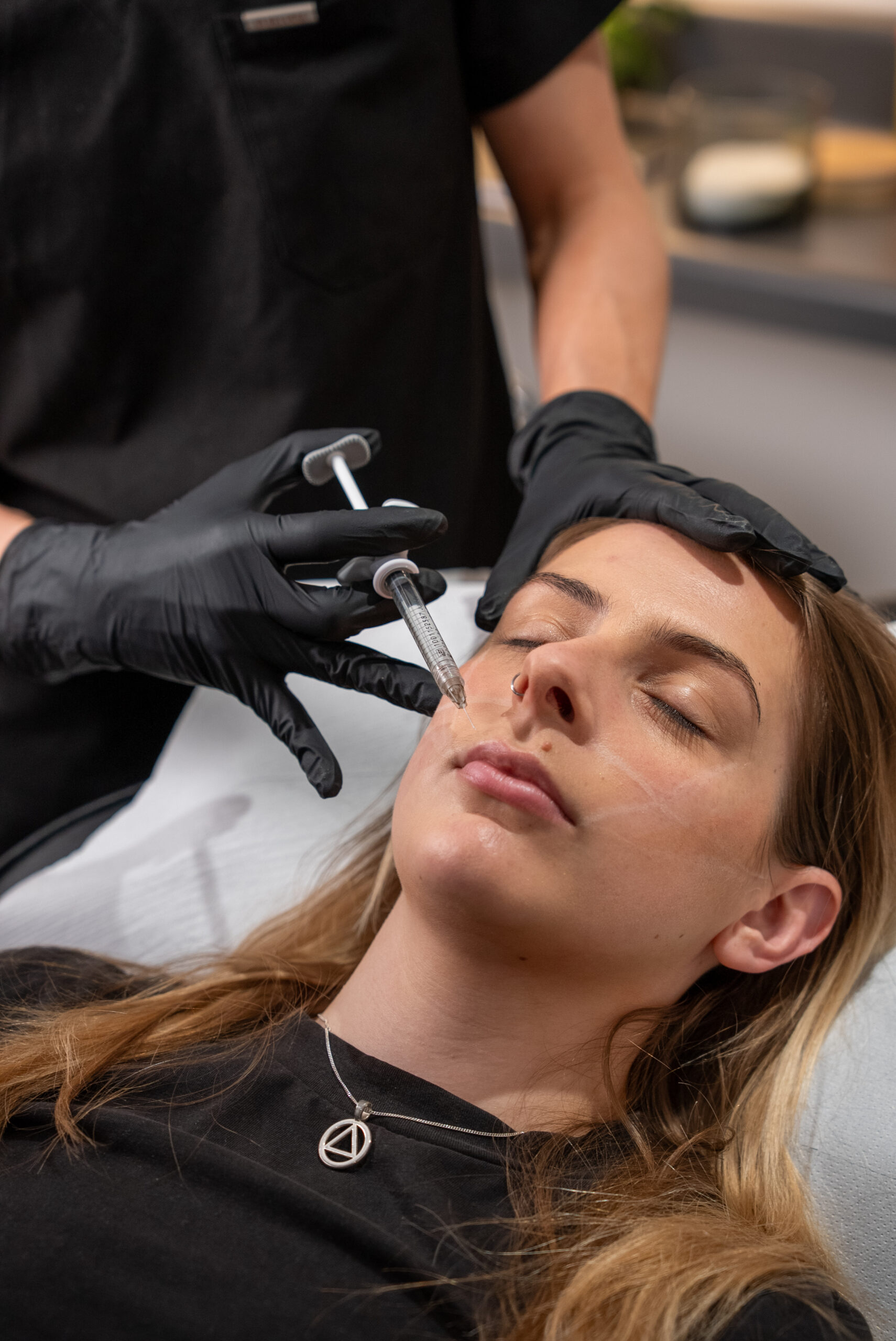 Skin tightening treatment at SculptSkin